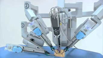 機(jī)器人制霸手術(shù)臺(tái) 外企壟斷格局下，國(guó)產(chǎn)普通機(jī)械制造的突圍之路